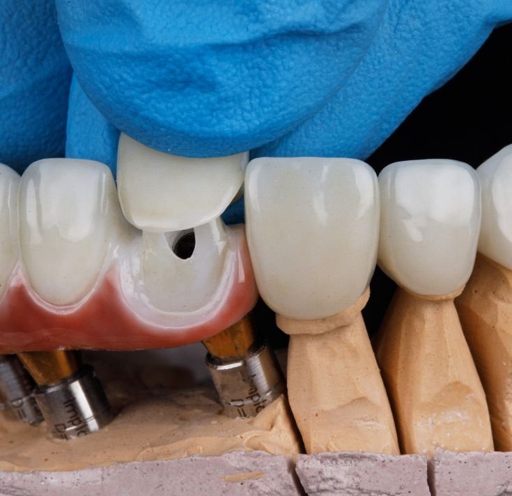 Composite Layering pic Composite Layering pic