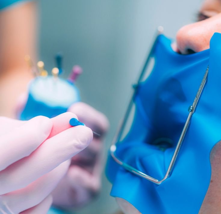 Rotary Endodontics img
